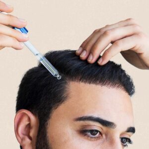 Hair Loss Treatment